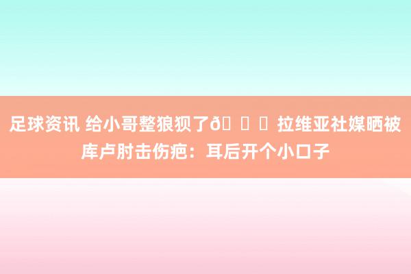 足球资讯 给小哥整狼狈了😅拉维亚社媒晒被库卢肘击伤疤：耳后开个小口子